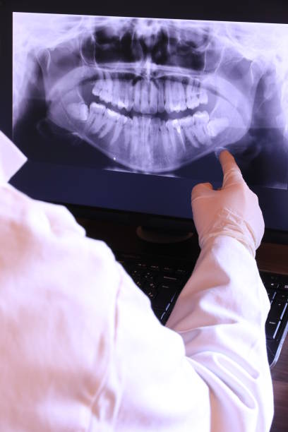Best Emergency Root Canal Treatment in Mitchell, IN