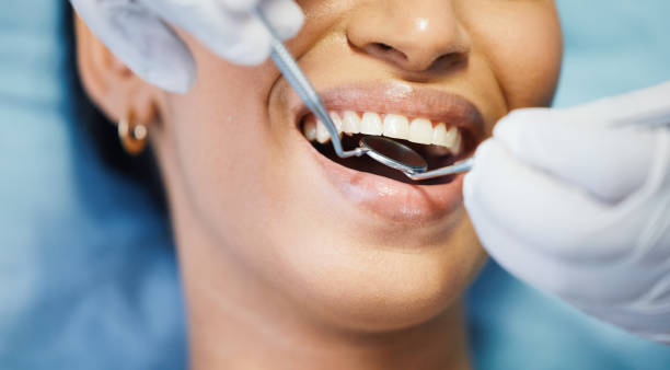 Best After-Hours Emergency Dentist in Mitchell, IN