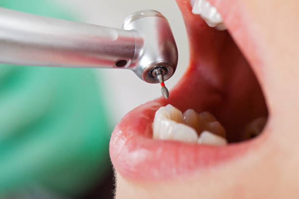Best Emergency Treatment for Toothache in Mitchell, IN